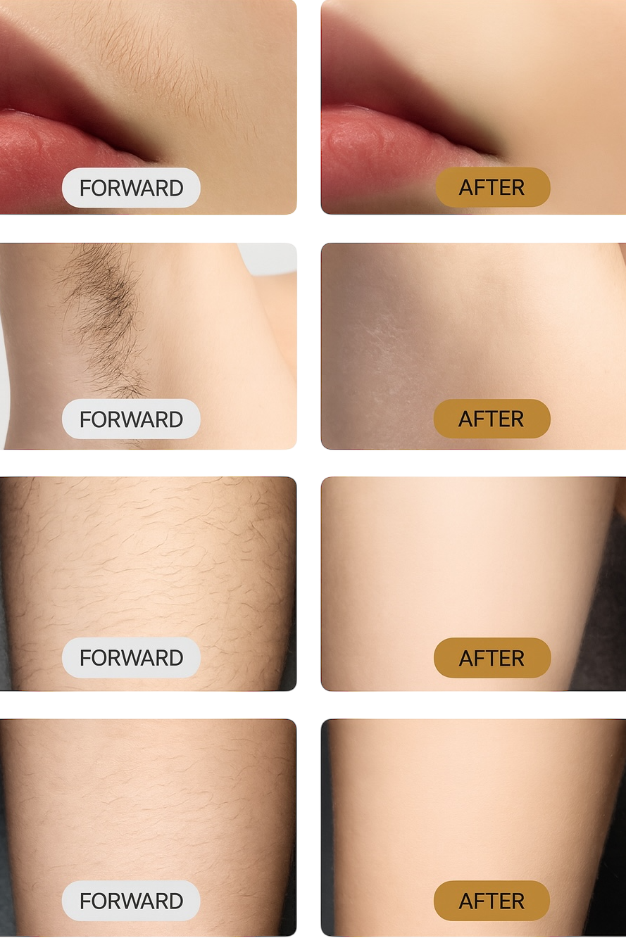Professional Laser Hair Removal