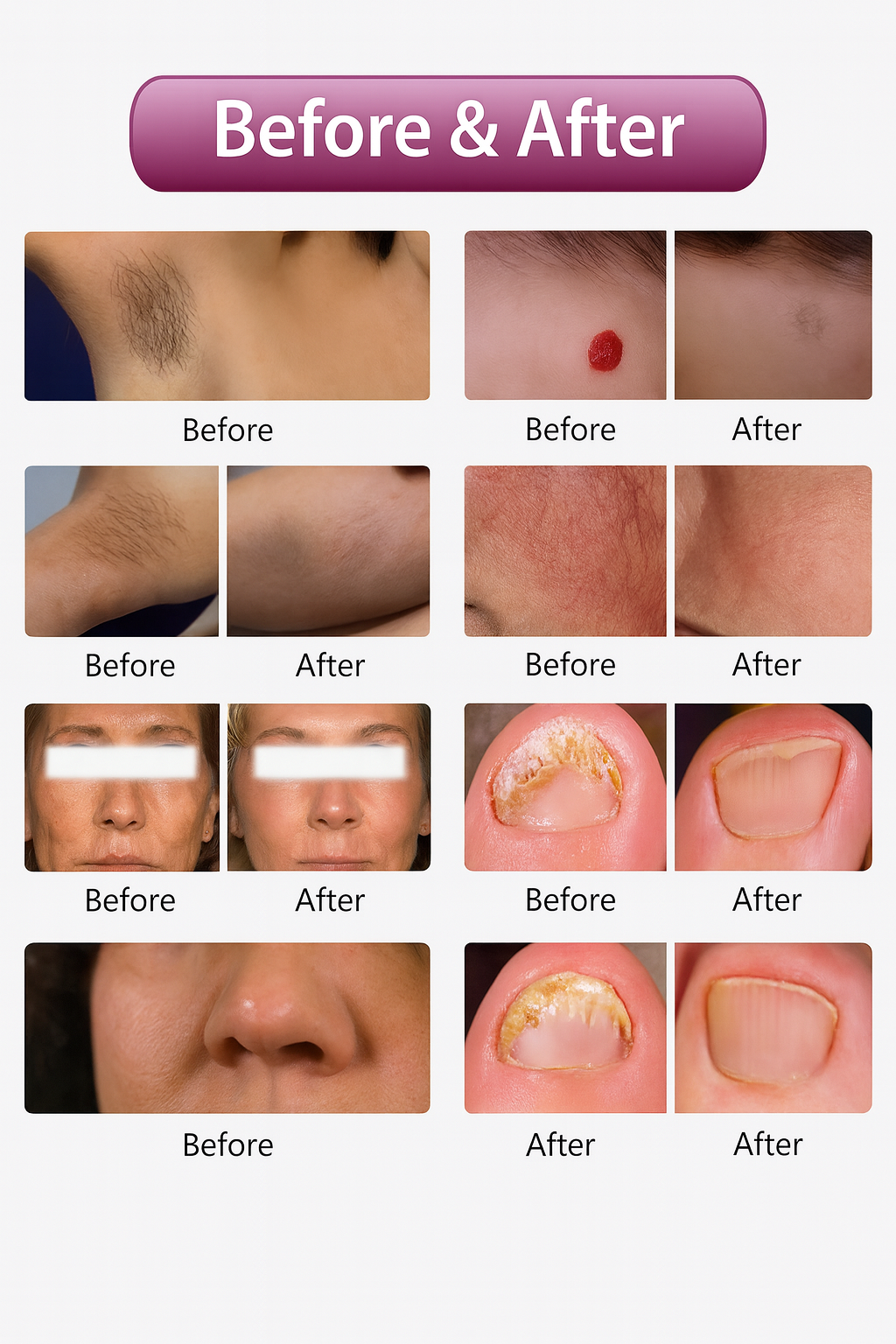 Professional Multifunction Laser 755nm / 808nm / 1064nm